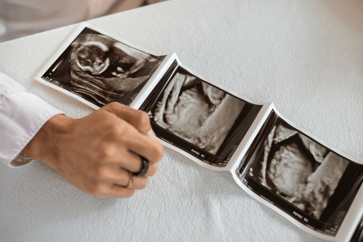 What Intended Parents Should Know Before Starting a Gestational Surrogacy Agreement in Florida