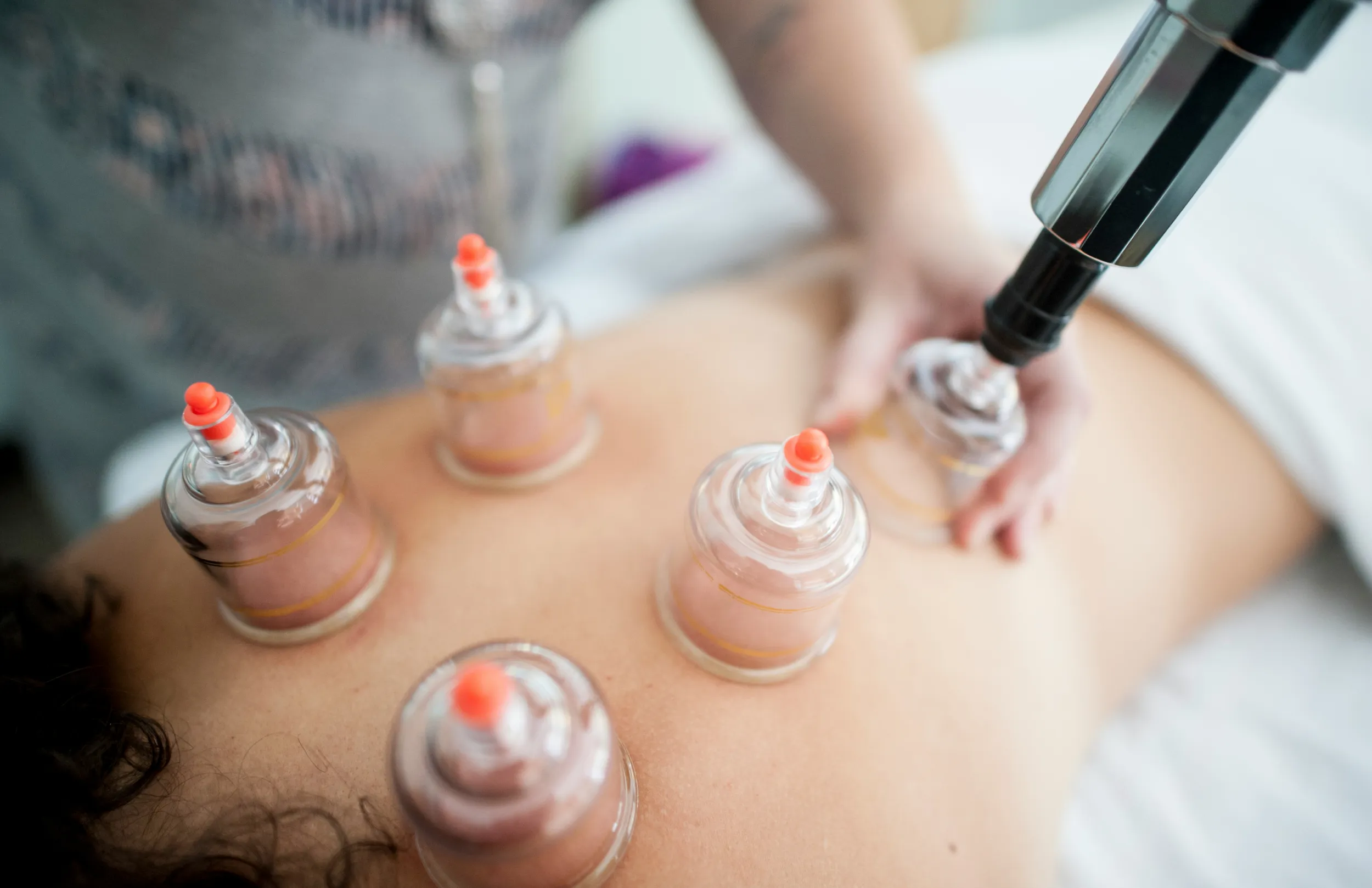 cupping massage behandeling