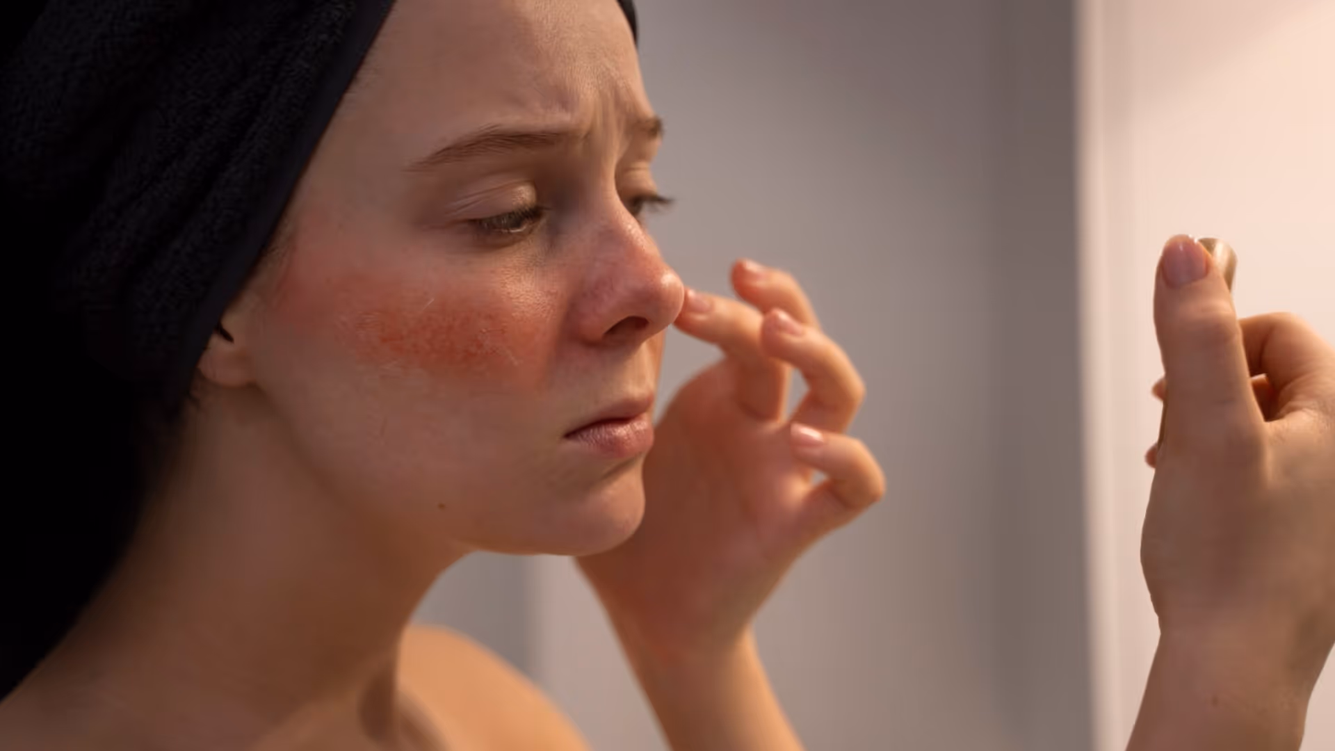 Femme avec turban noir regardant dans un miroir, peau présentant des plaques rouges de rosacée bilatérales sur les joues et le nez