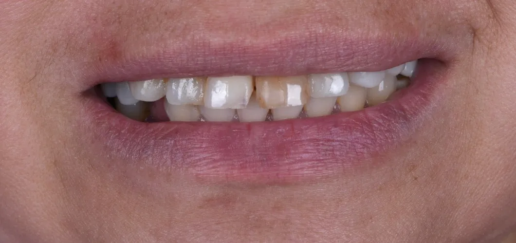 Before Image