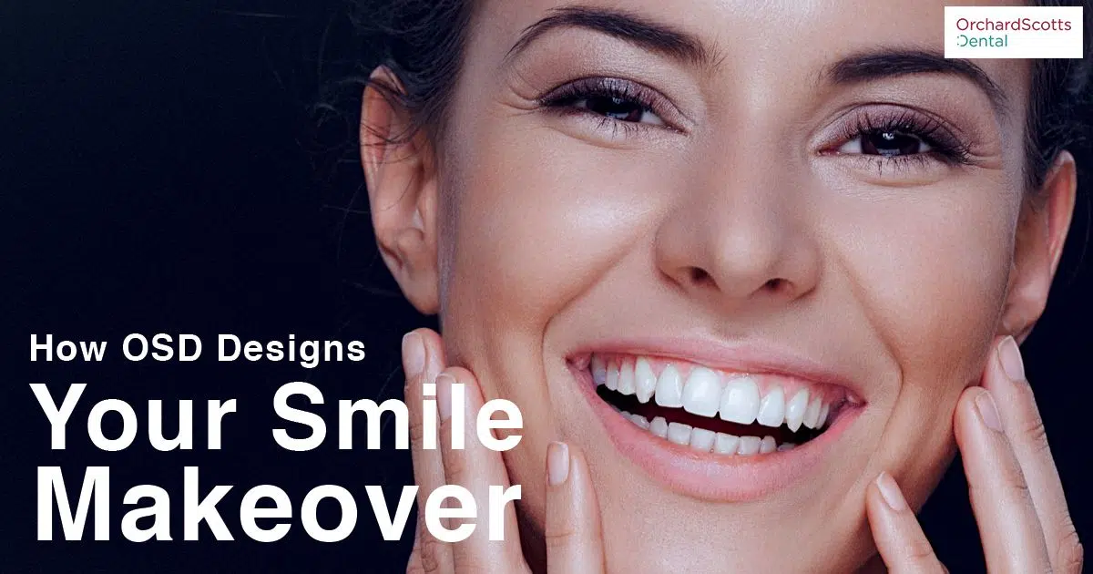 How OSD Designs Your Smile Makeover