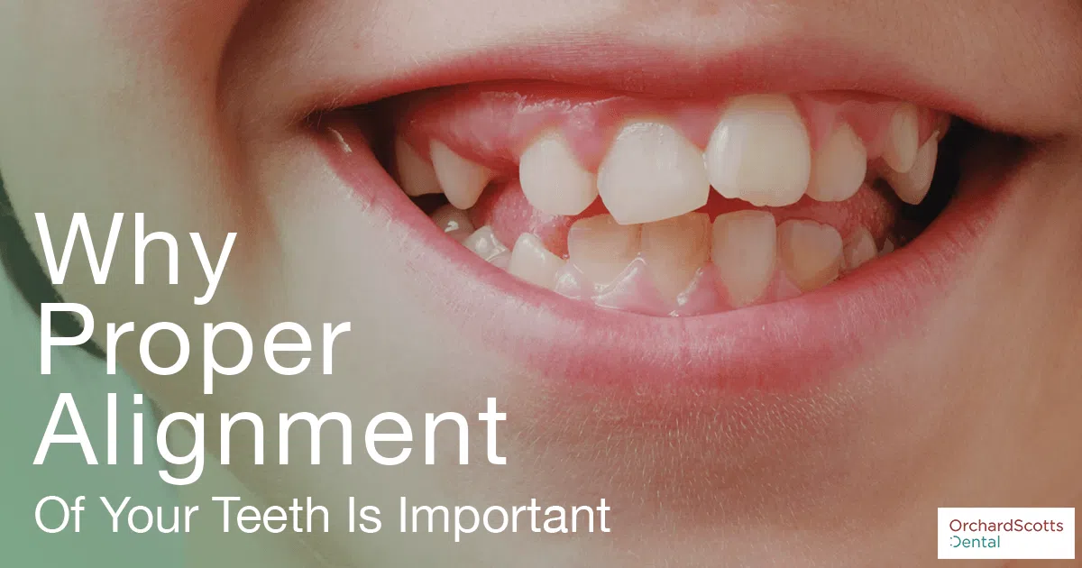 Why Proper Alignment of Your Teeth Is Important