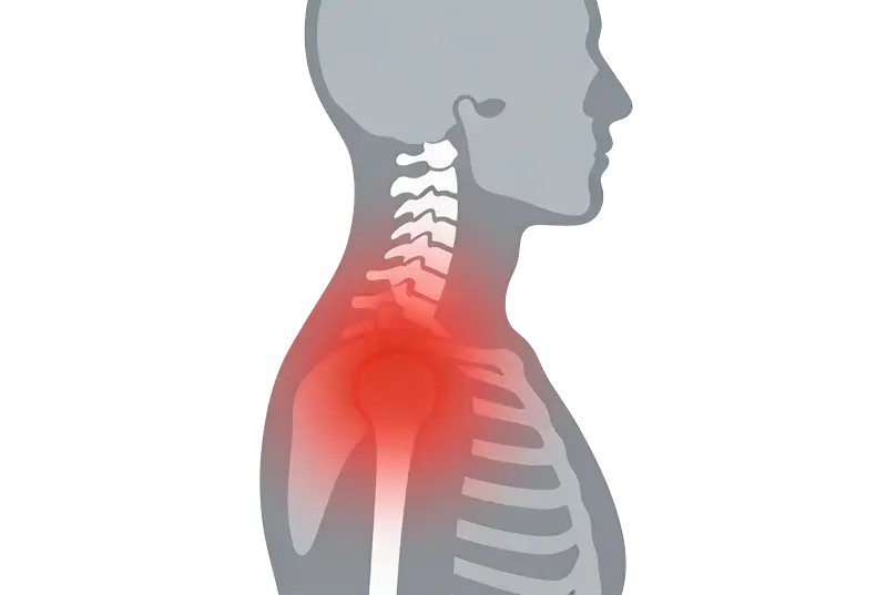 Illustration showing shoulder joint pain with red highlights in a gray skeletal outline of the upper body.