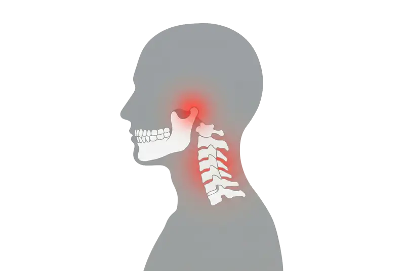 Side view of skull and neck bones with red highlights on jaw joint and upper cervical spine indicating pain.