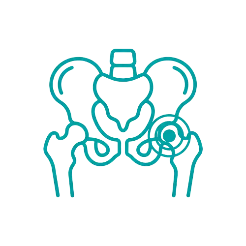 Hip and pelvic alignment illustration representing chiropractic treatment at Prime Wellness Chiropractic in Penshurst