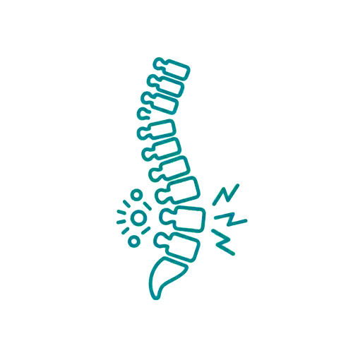Spinal dysfunction and postural strain illustration treated by Prime Wellness Chiropractic in Penshurst