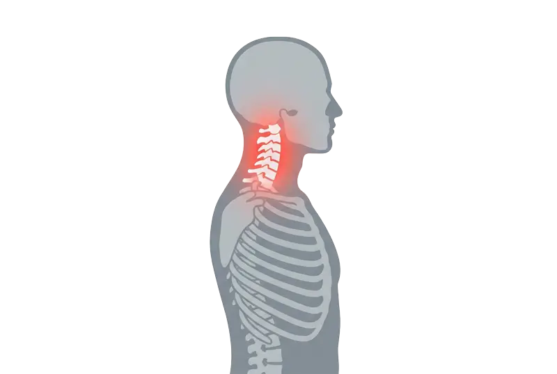 Neck pain and headache management at Prime Wellness Chiropractic in Penshurst NSW