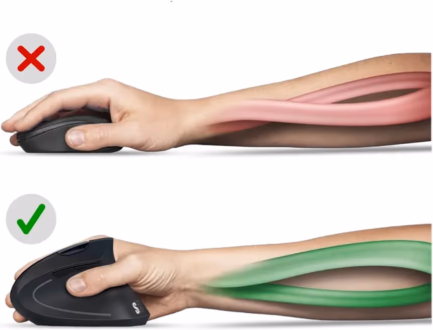 SUBBLIM Glide Vertical Ergo Dual Blanc - vue 5