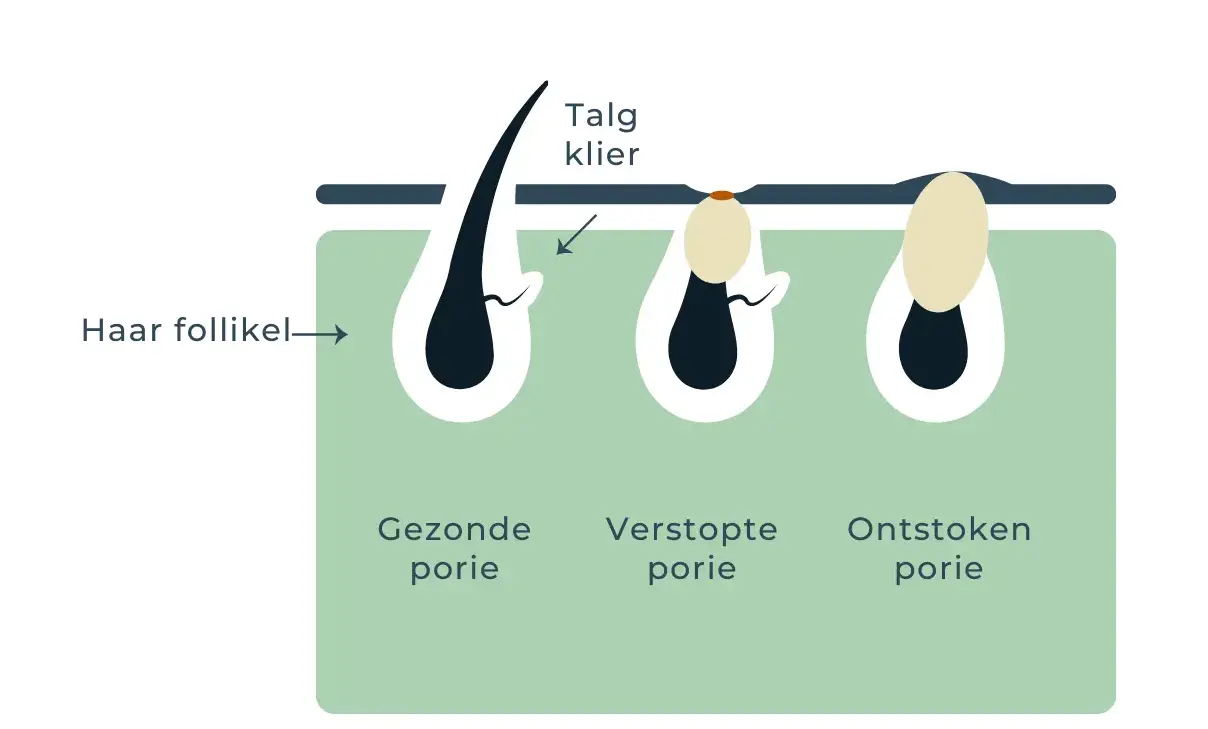 Illustratie met uitleg haaruitval en behandelingen