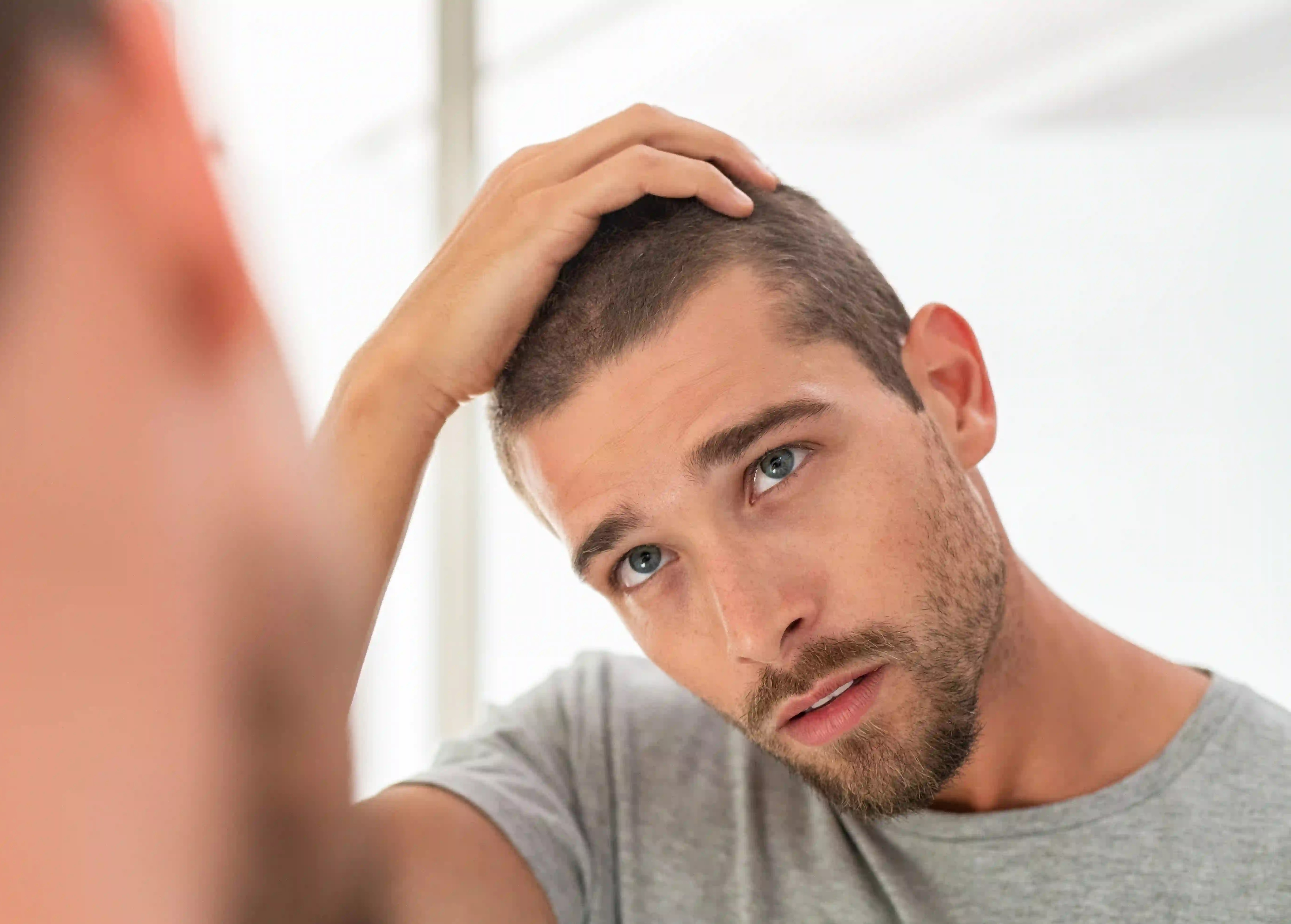 Quelles sont les alternatives à la greffe de cheveux ? | Fellos