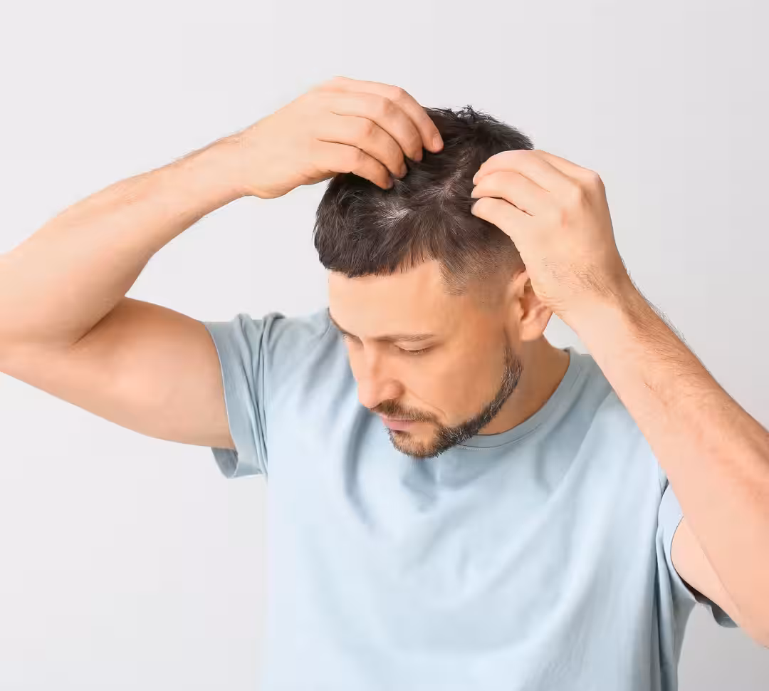 Finasteride or dutasteride for hair loss? | Fellos review 