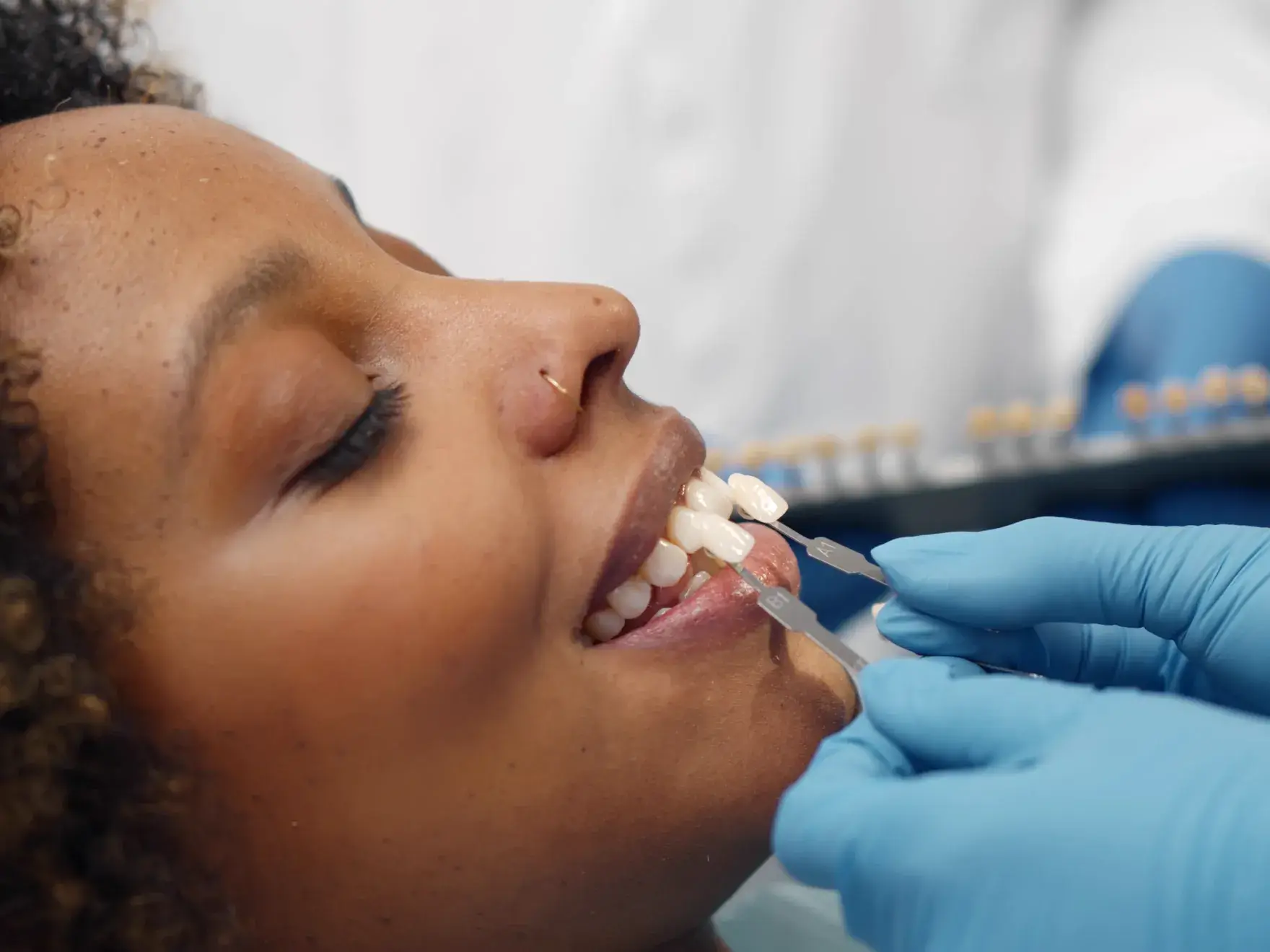 Dental professional with blue gloves holds shade guide next to a smiling woman's teeth to match veneer color.