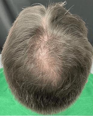 Before and after images