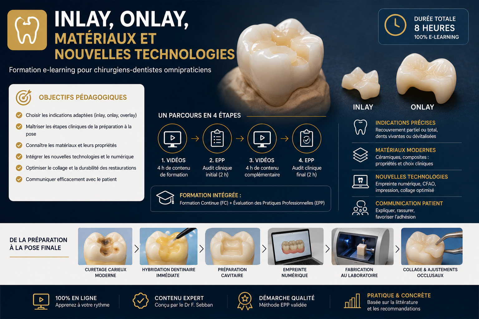 Illustration pédagogique présentant une restauration dentaire inlay onlay, les étapes cliniques, les matériaux modernes et le parcours e-learning pour chirurgiens-dentistes.
