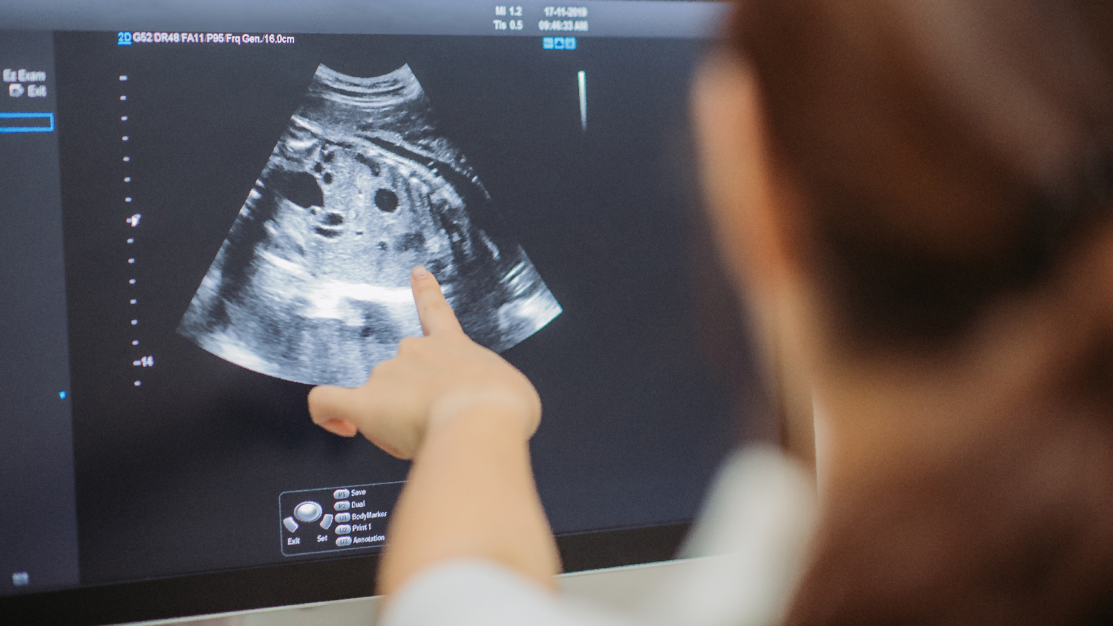 Monitoring Progress & Red Flags