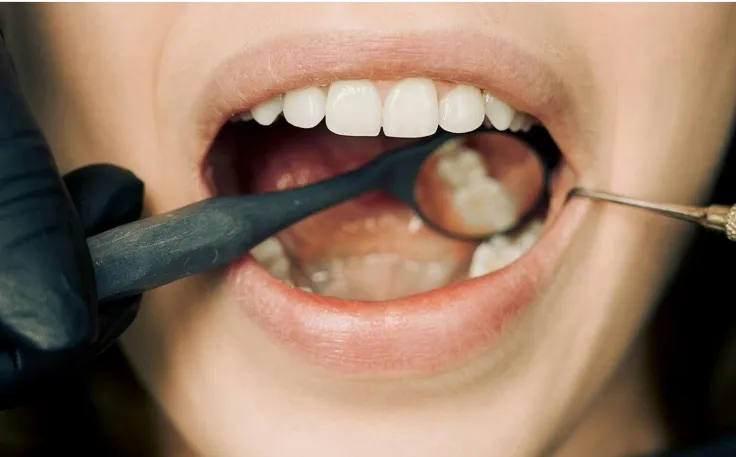 Appointment Mouth Image