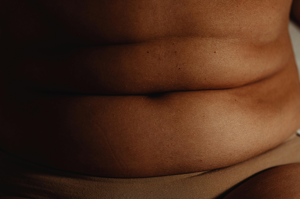 Wegovy et Mounjaro après une chirurgie bariatrique : Une solution efficace pour maintenir la perte de poids ?