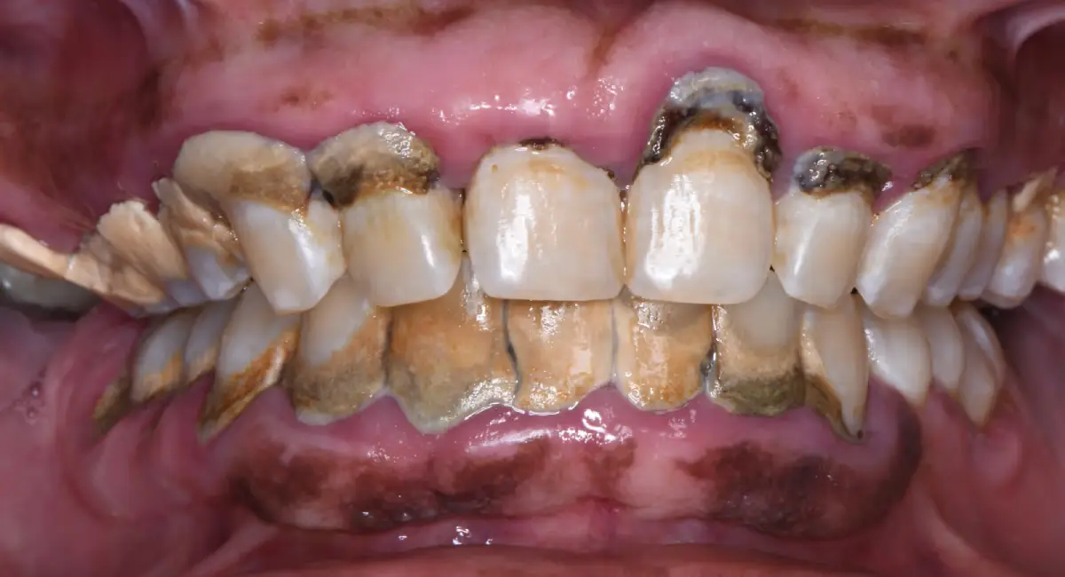 Before Image