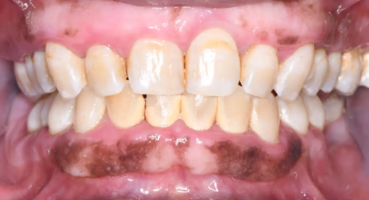 After Image