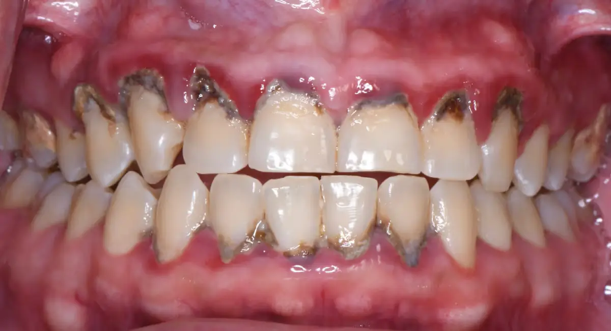 Before Image