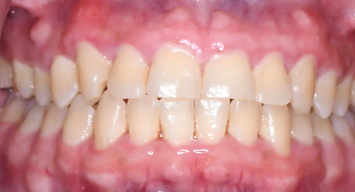 After Image