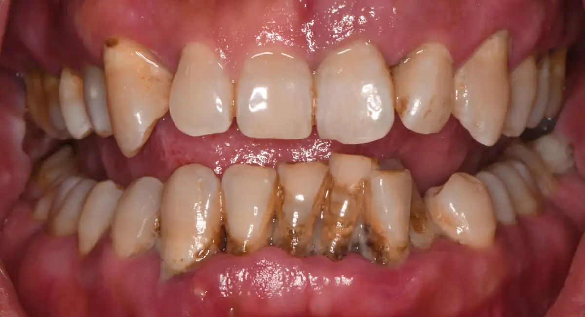 Before Image