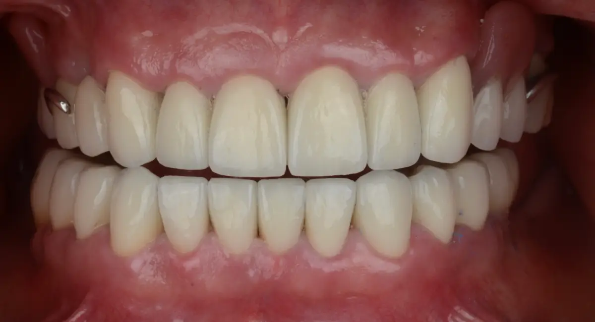 After Image