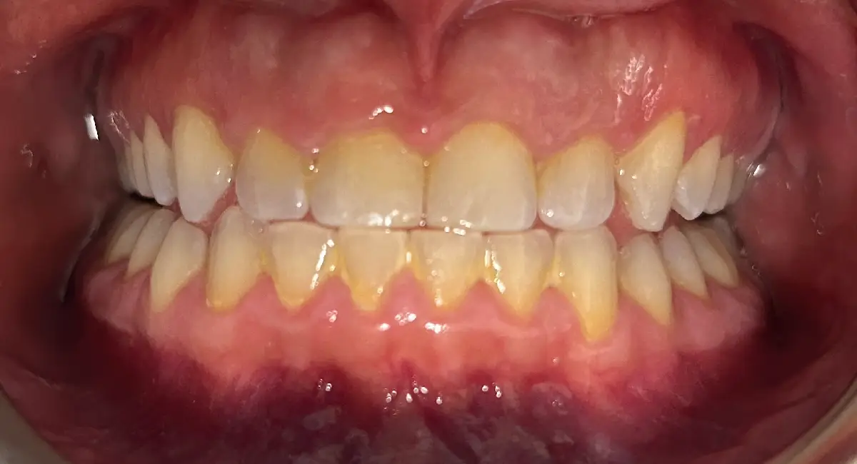 Before Image