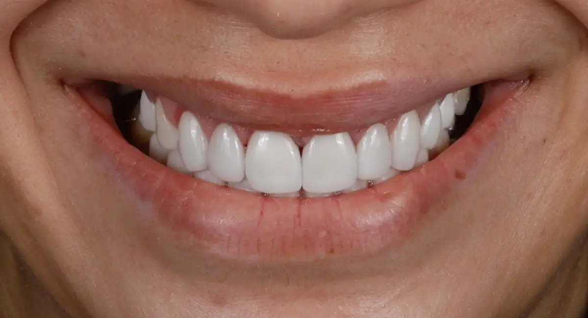 After Image