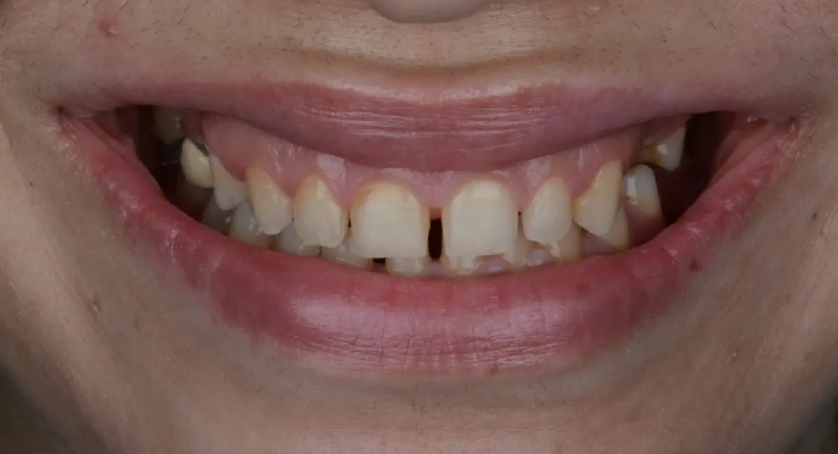 Before Image