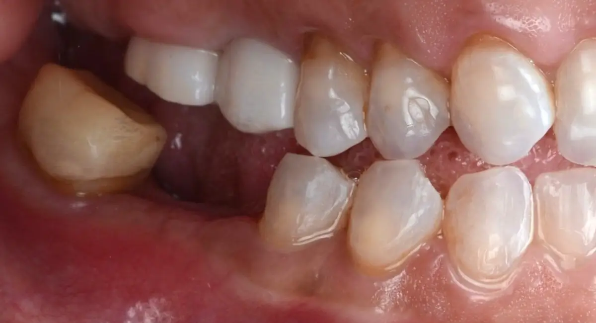 Before Image