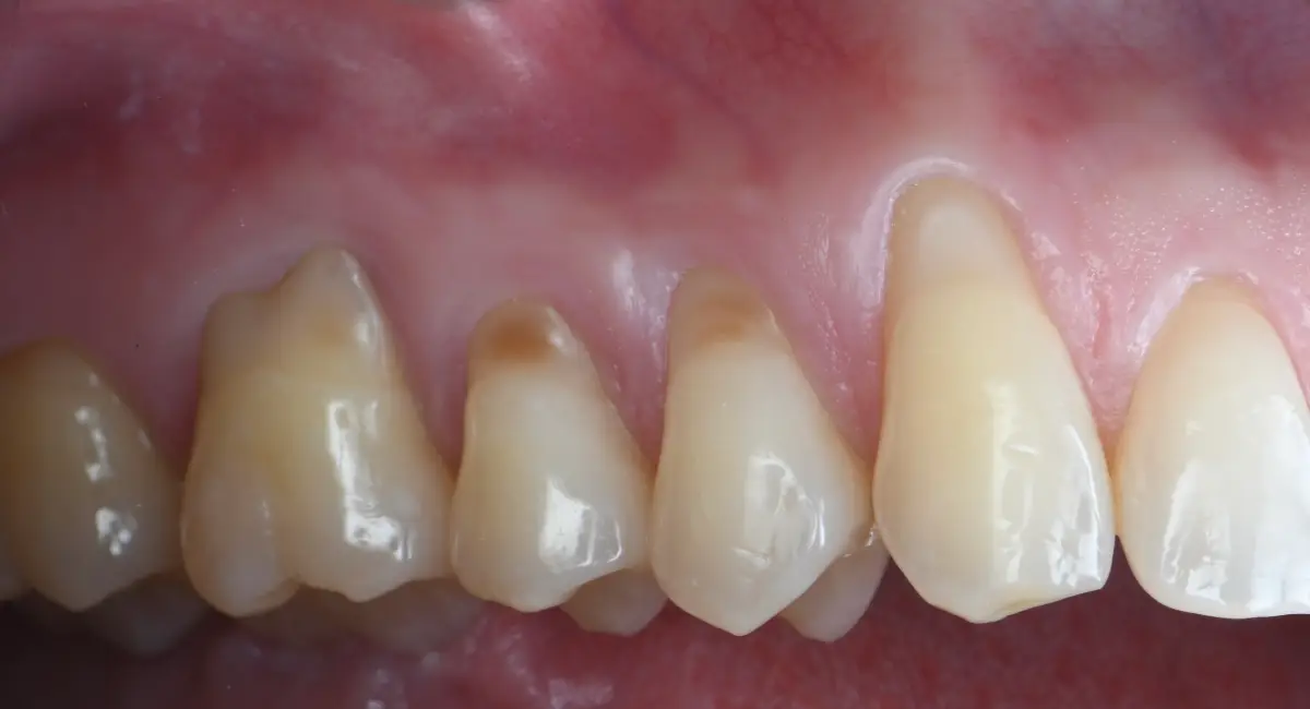 Before Image
