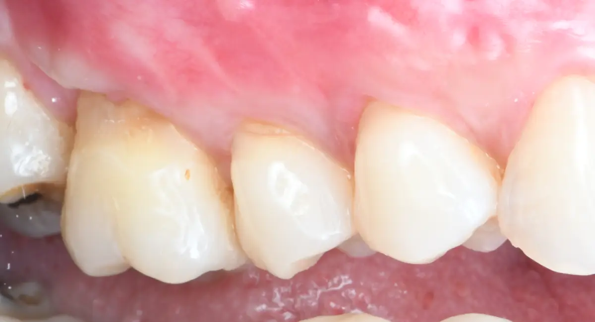 After Image