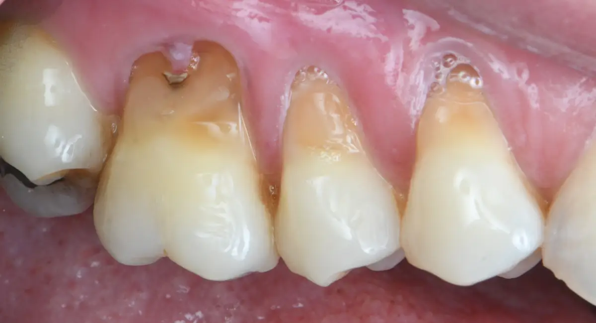 Before Image