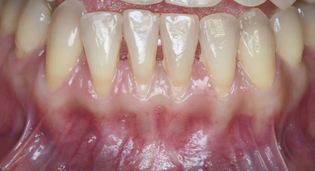 Before Image