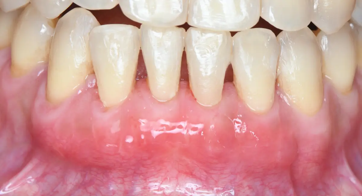 After Image