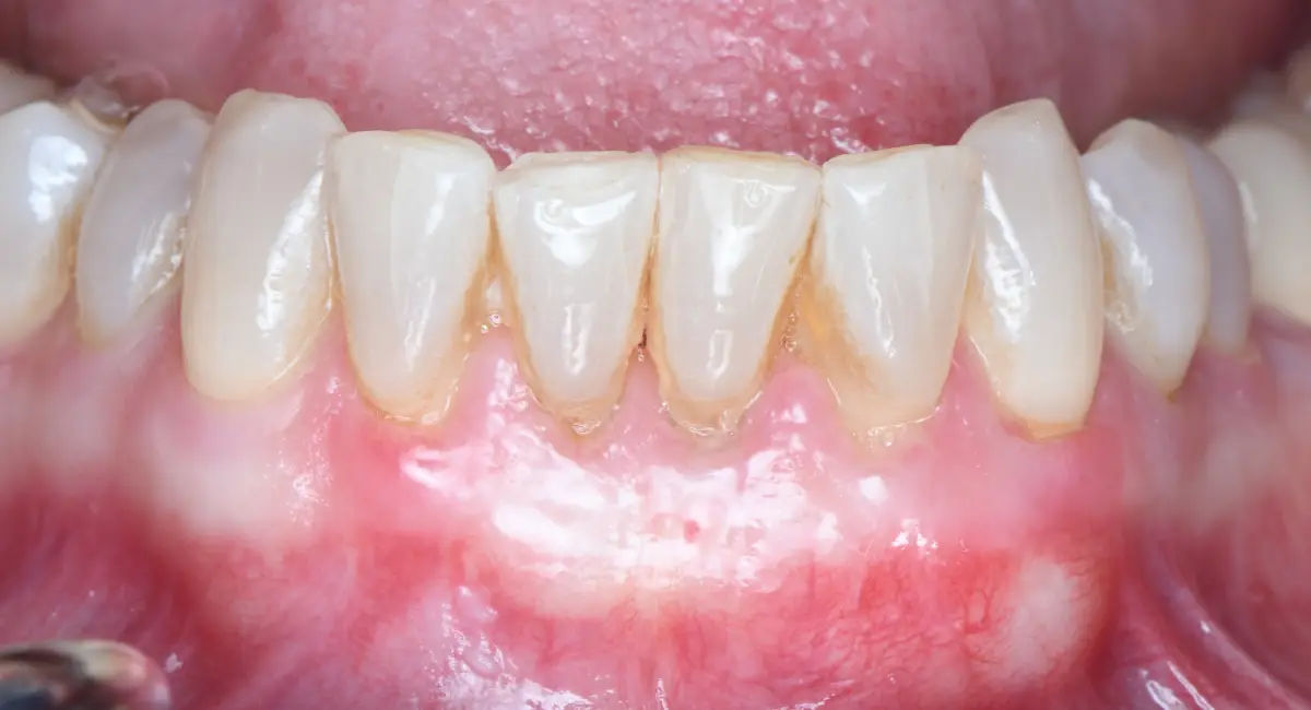 After Image