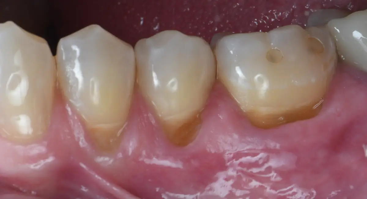 Before Image