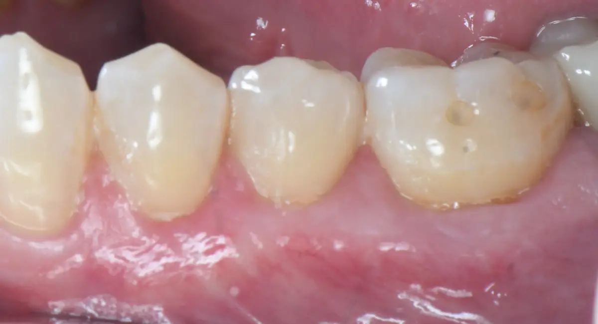 After Image
