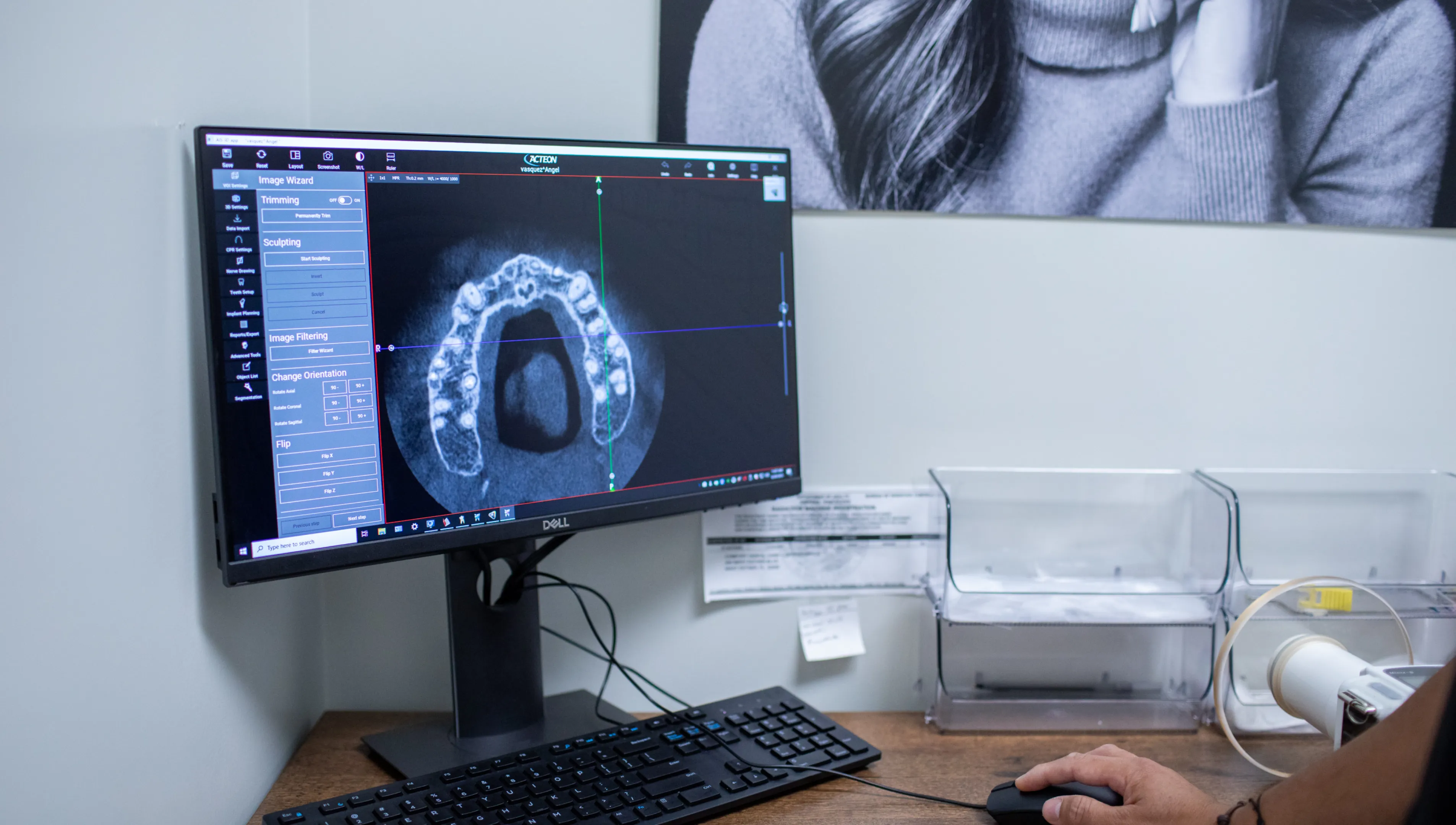 Person uses a computer showing a dental X-ray on the screen.