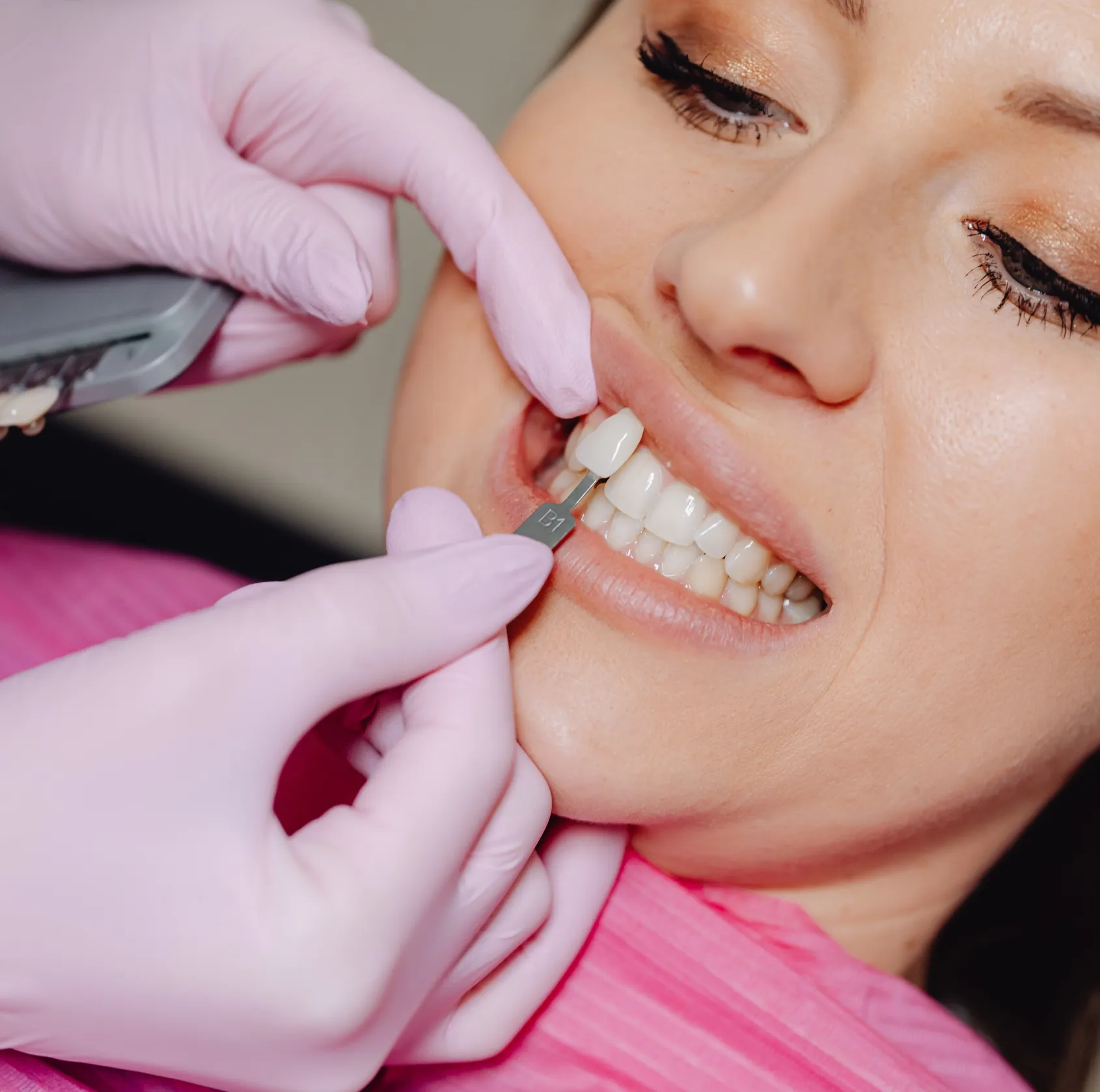 A dentist compares a tooth shade guide to a woman's teeth for color matching.