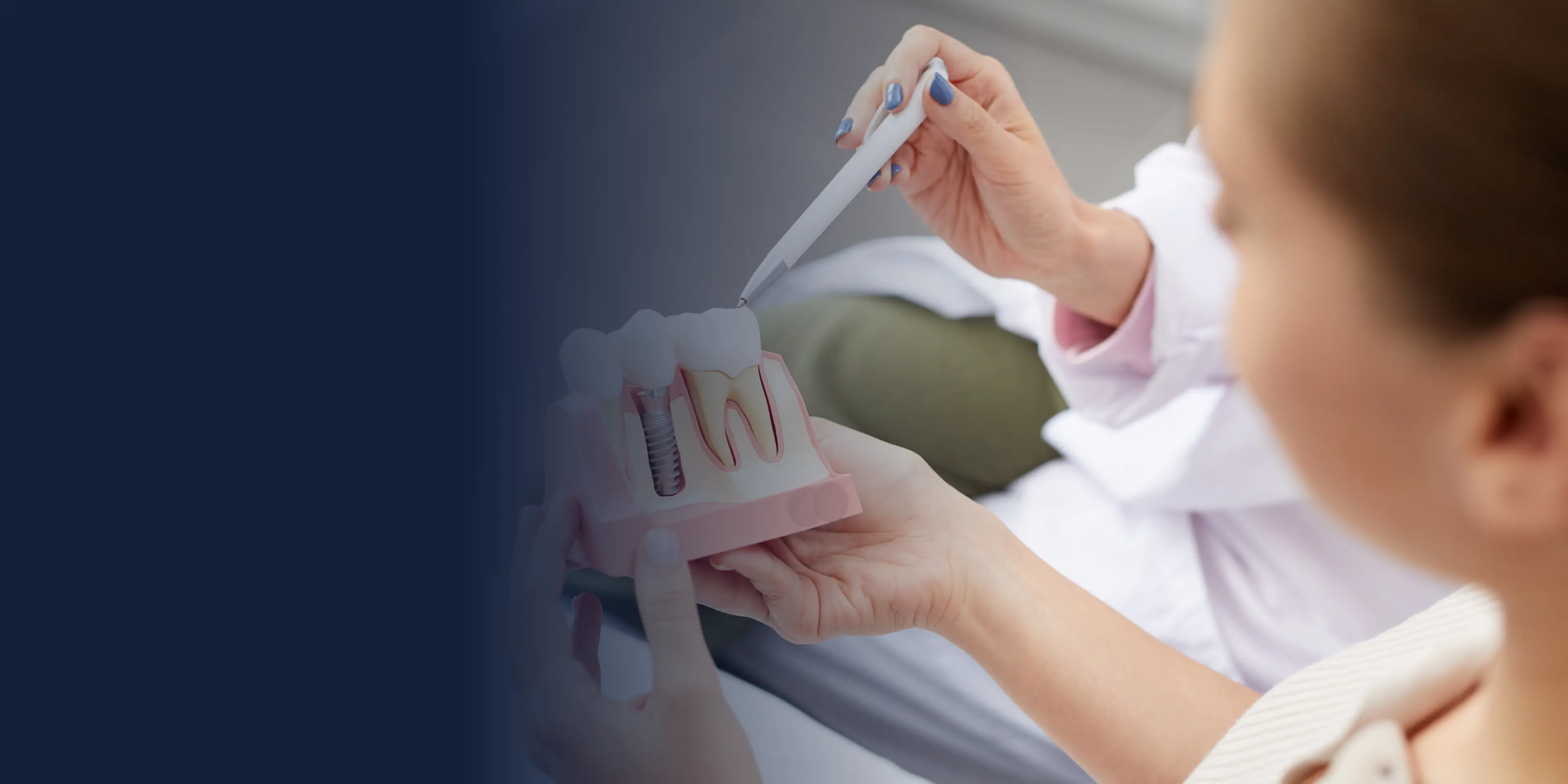A dentist explains a dental implant model to a patient using a pointing tool.