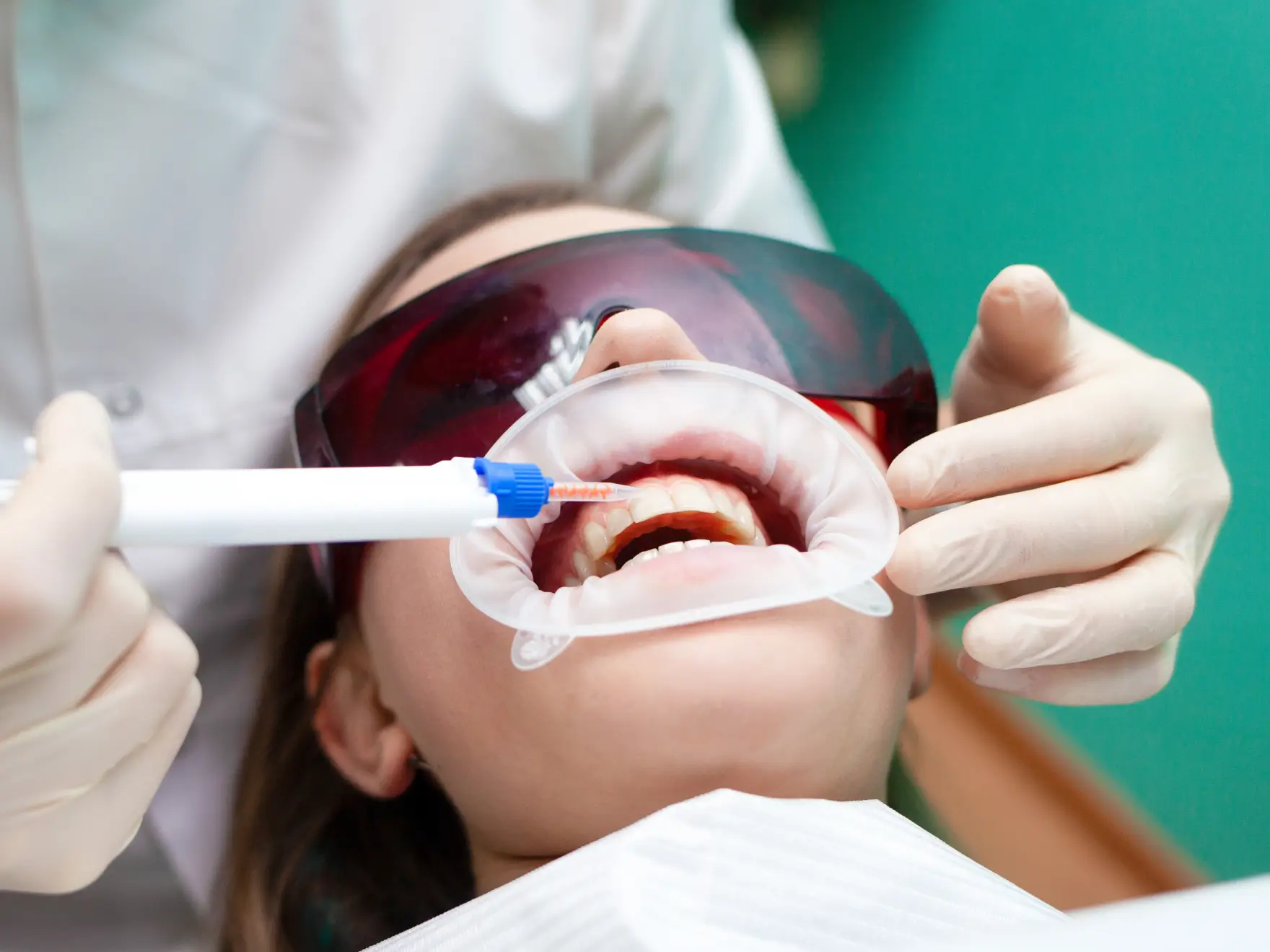 Dentist uses a tool on a patient's teeth while the patient wears protective glasses.