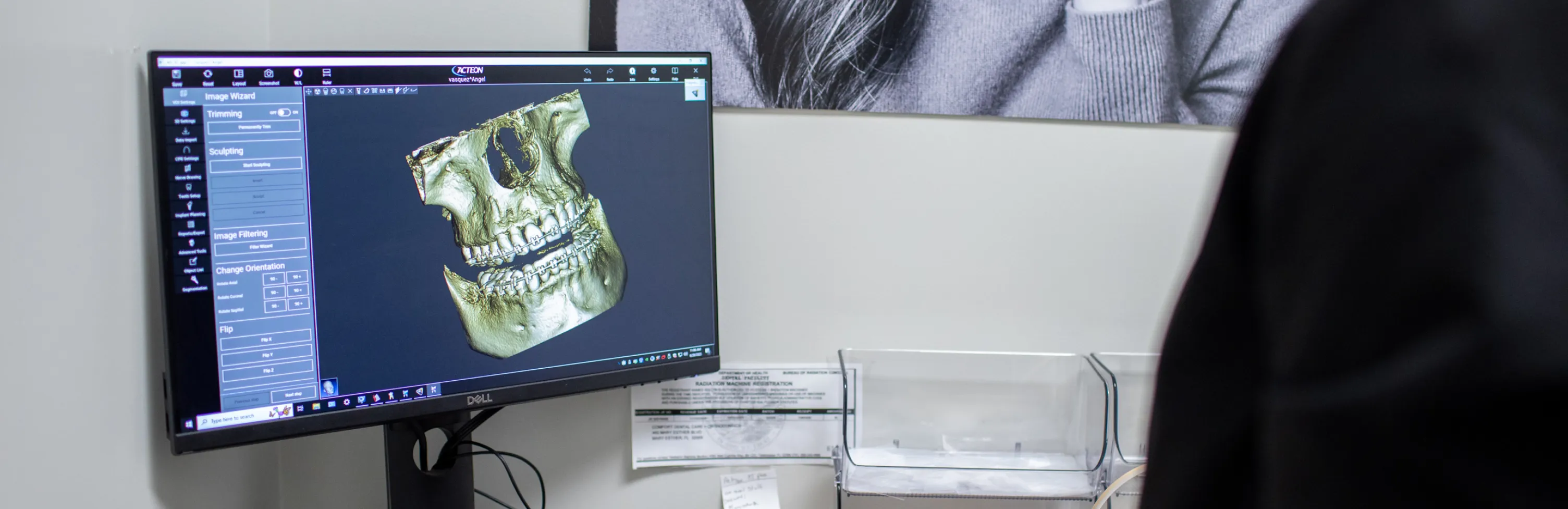 Need a Second Opinion in Mary Esther? Trust Comfort Dental Care and Orthodontics for Reliable Dental Advice