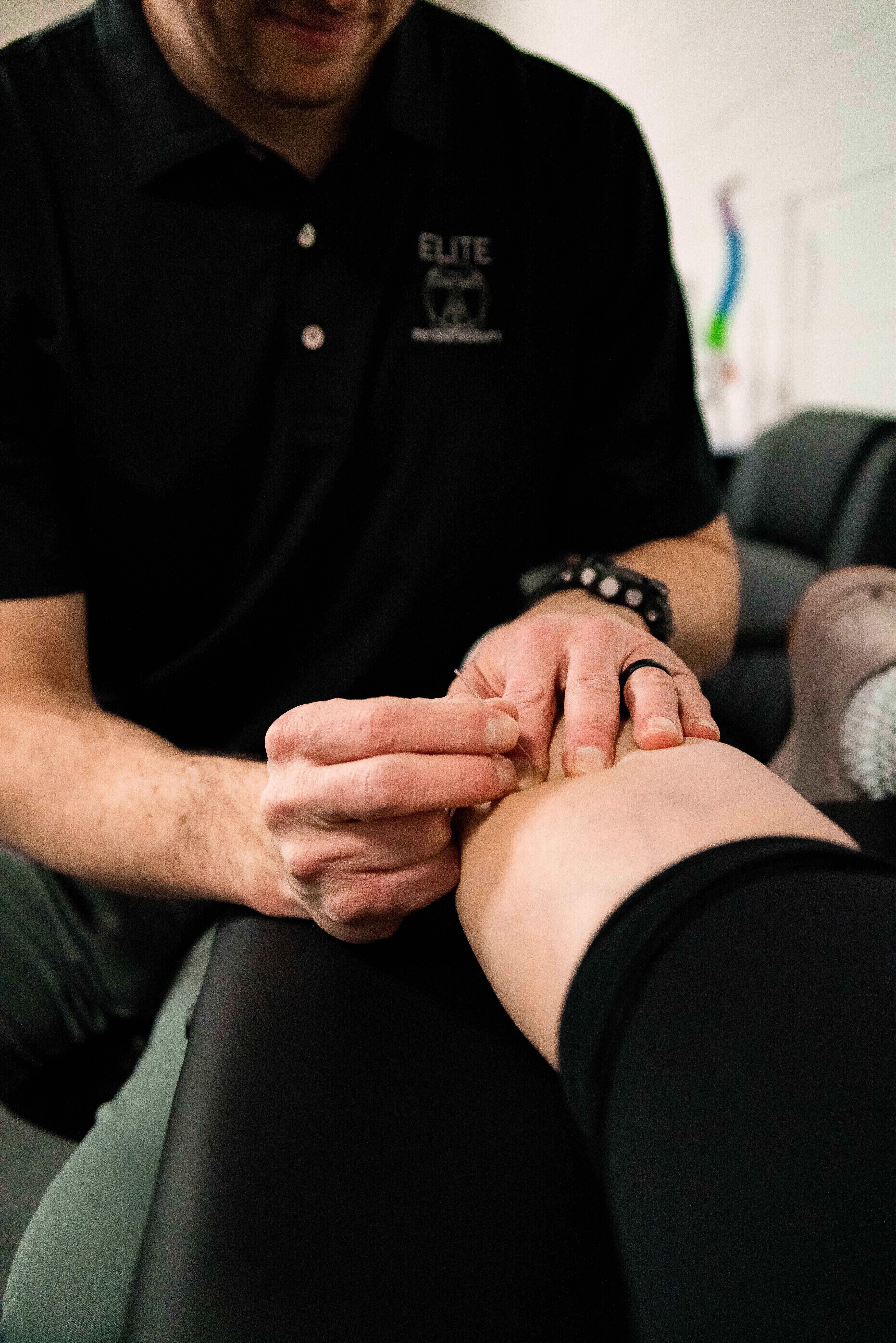 Therapist performing dry needling treatment on a patient's knee.