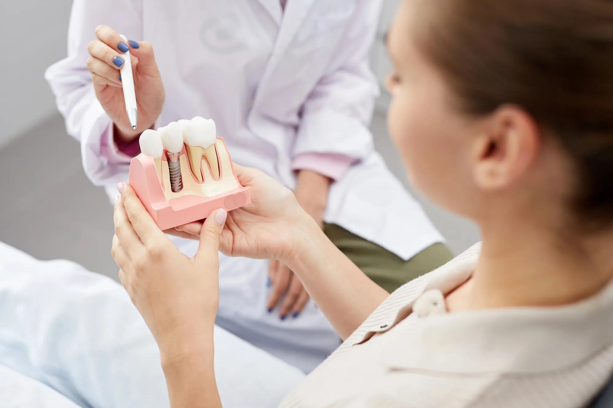 Dentist shows a dental implant model to a patient holding the model in hands.