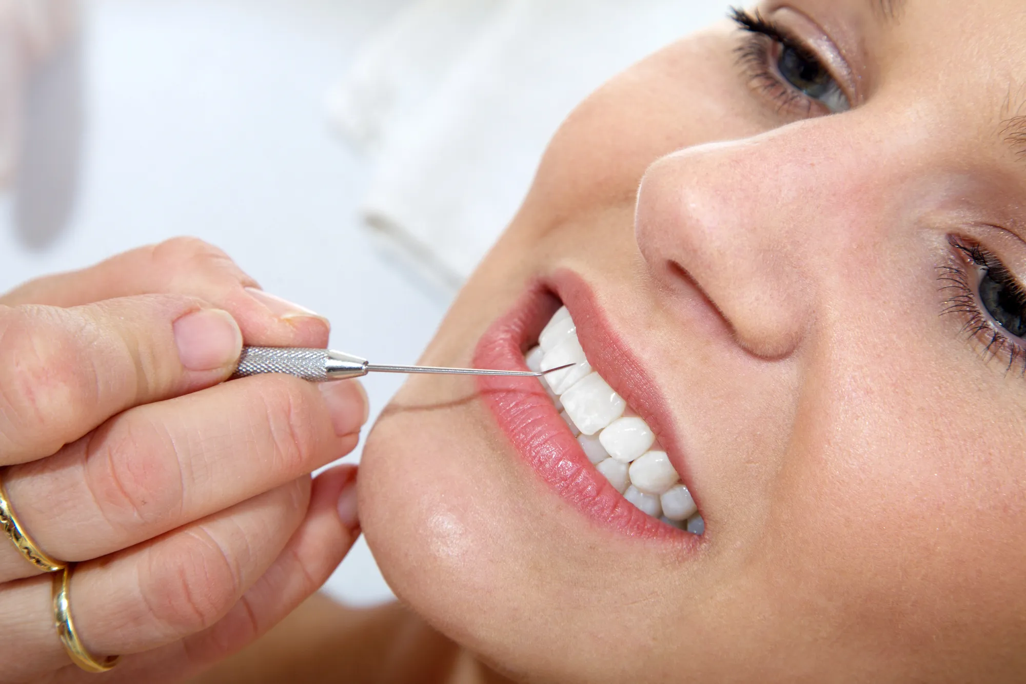 Close-up of a dental tool examining the front teeth of a smiling woman.