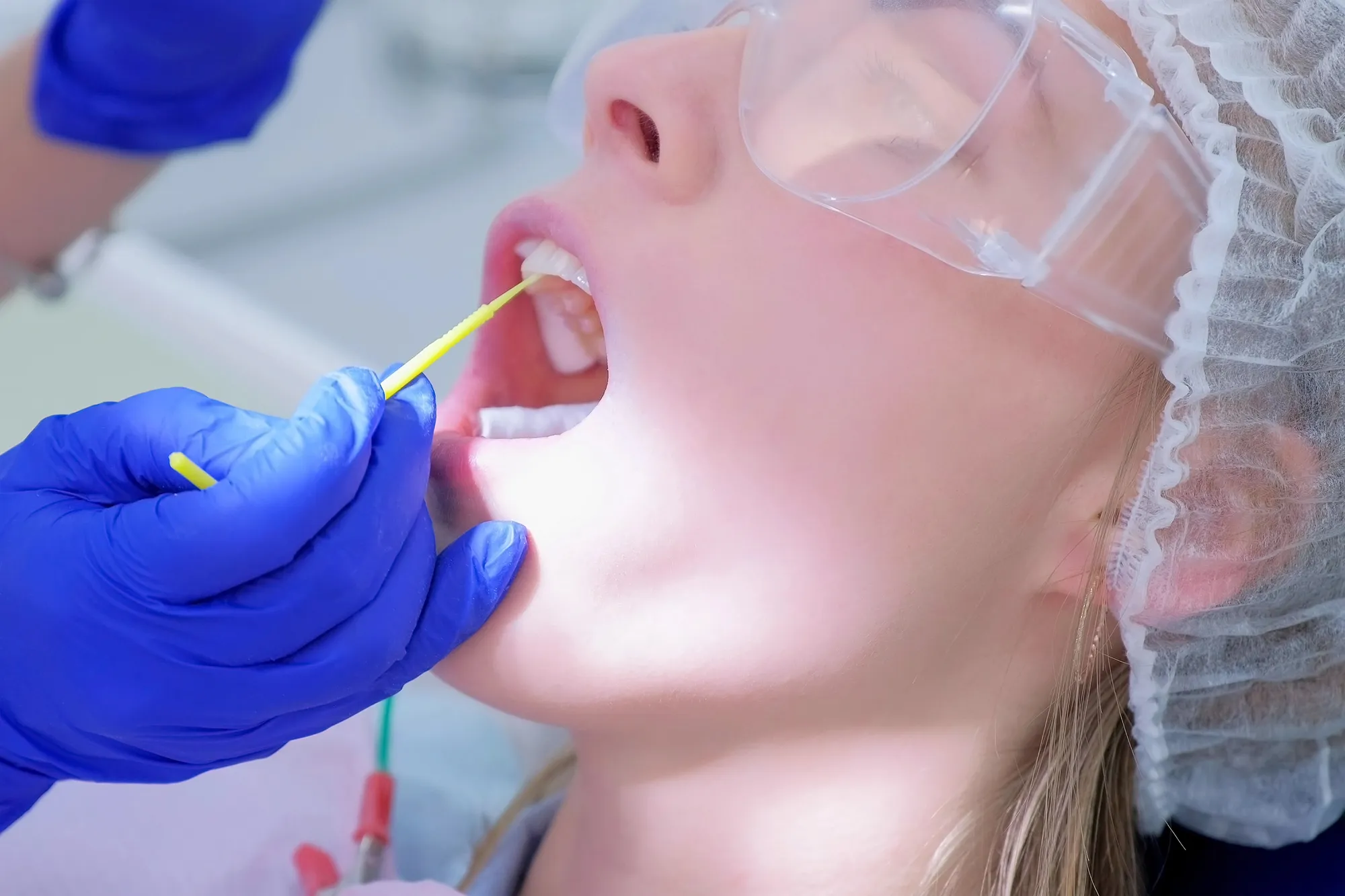 Close-up of a patient wearing protective goggles receiving oral swab from gloved hands in medical setting.