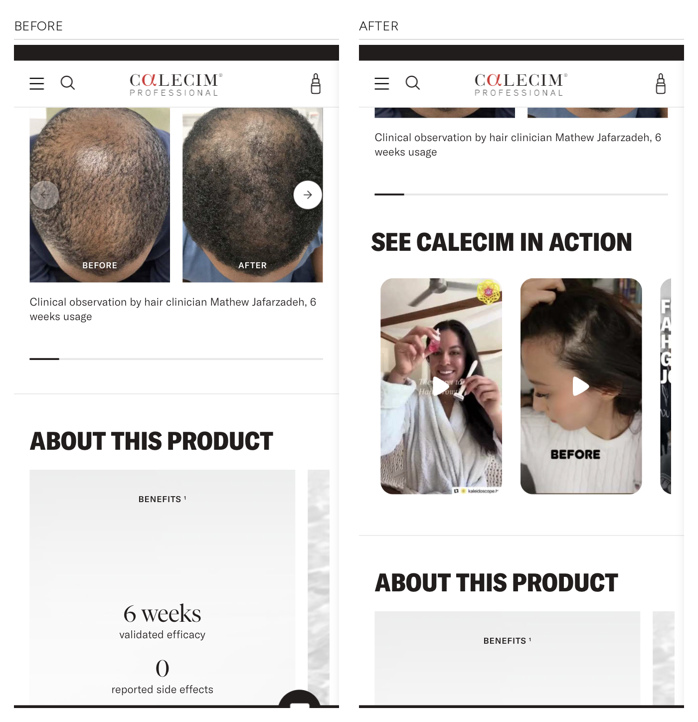 CALECIM Professional mobile hair product page, before and after: a clinician before-and-after carousel running straight into the product description, replaced by the same page with a See Calecim In Action row of customer video clips inserted between the two