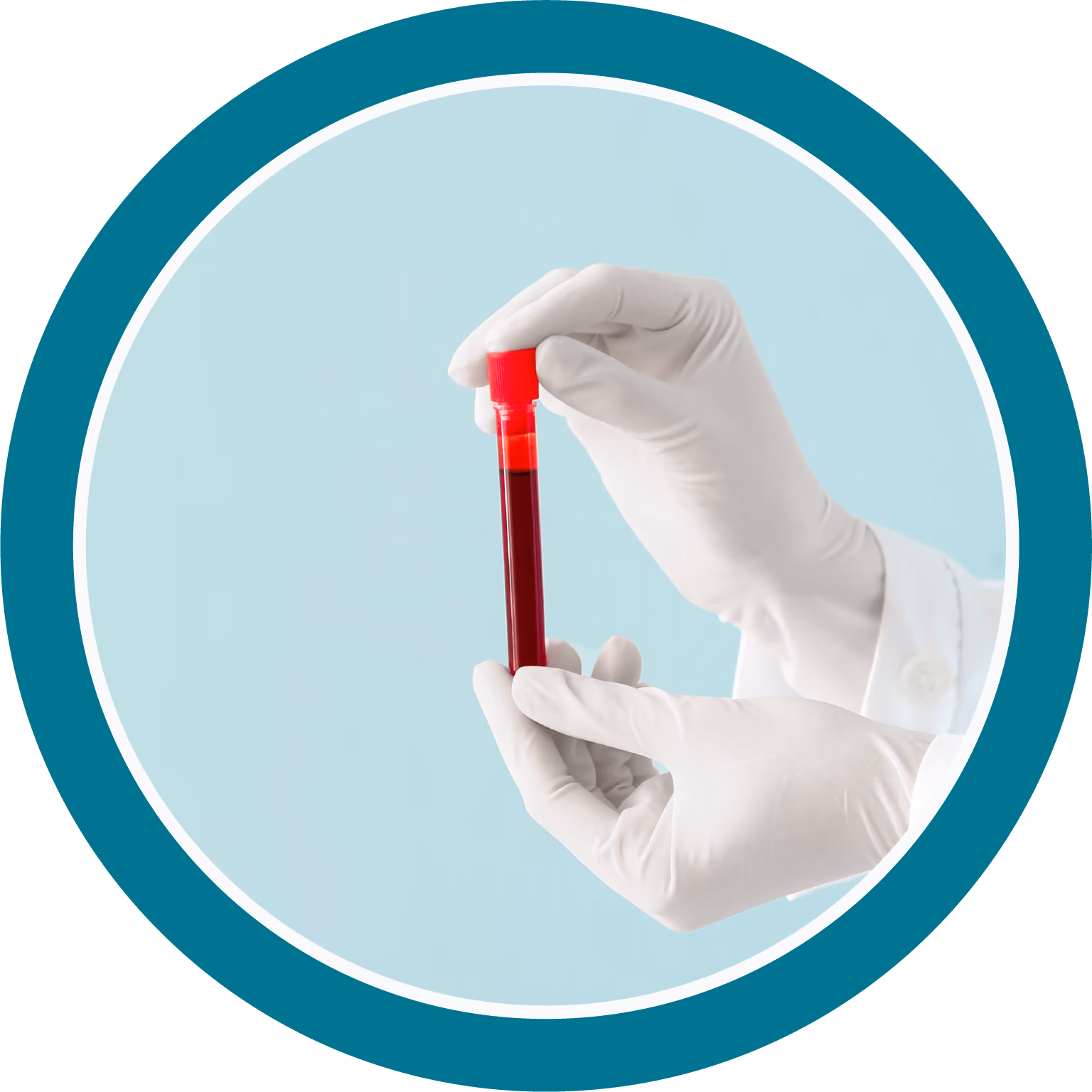 Hands wearing white gloves holding a test tube filled with blood against a light blue background.